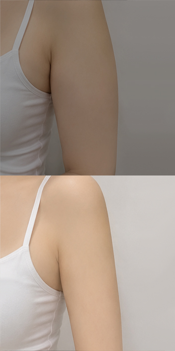 바비라인의원 전후사진