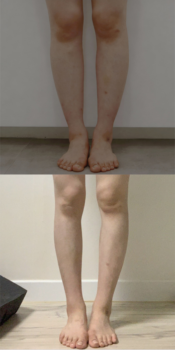 바비라인의원 전후사진