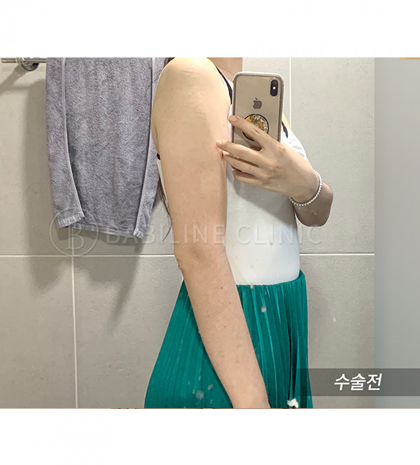 Before 임시 이미지 01